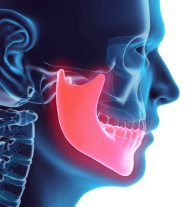 TMJ Treatment La Quinta, CA